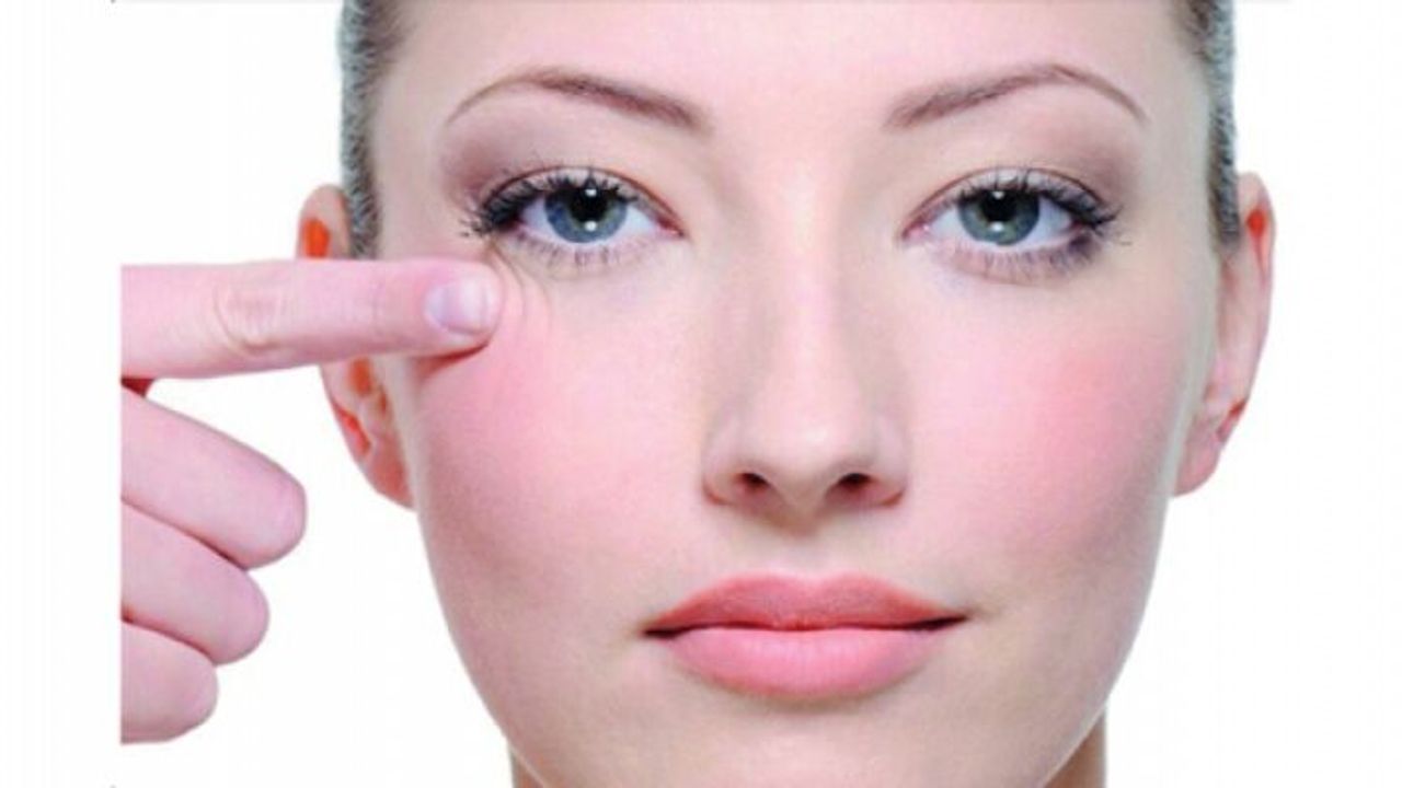 Önce göz çevresinde ortaya çıkıyor.