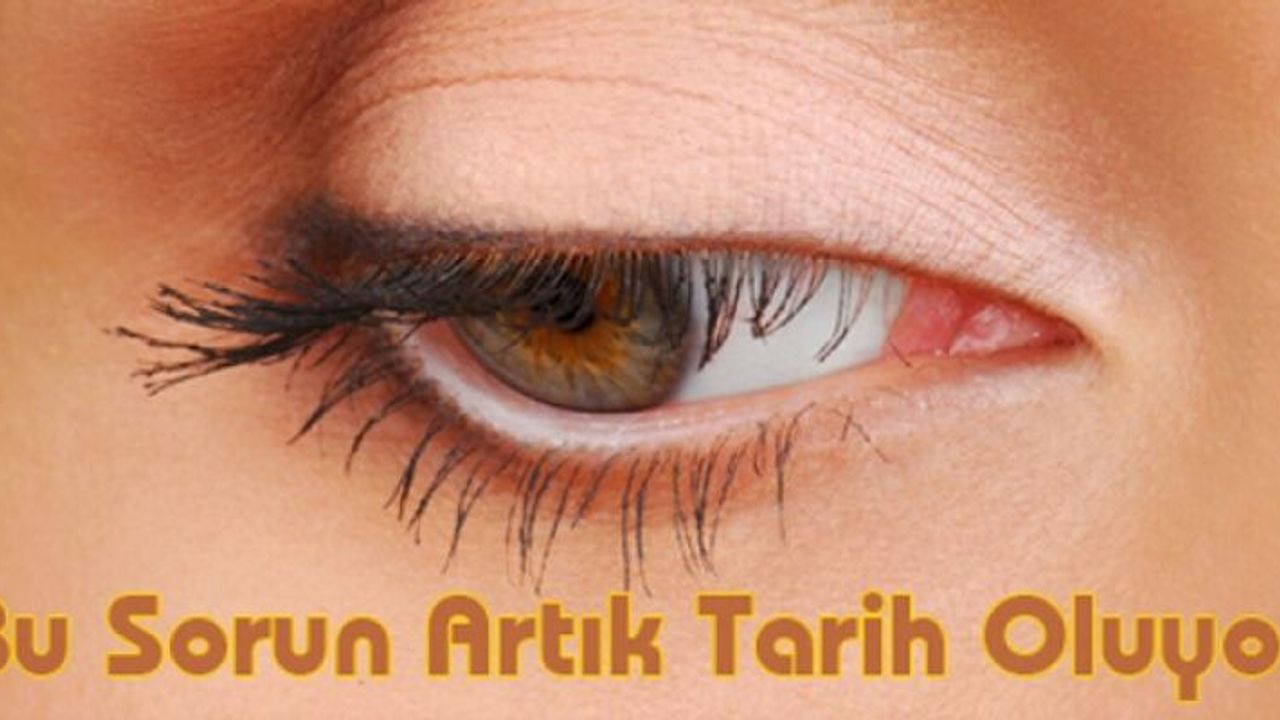 Görmeye engel durum ortadan kaldırılabiliyor.