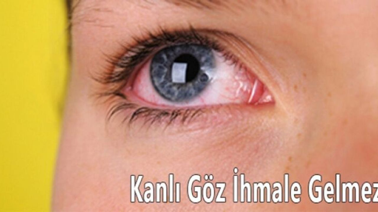 Kornea da beyaz noktalar oluşabilir.