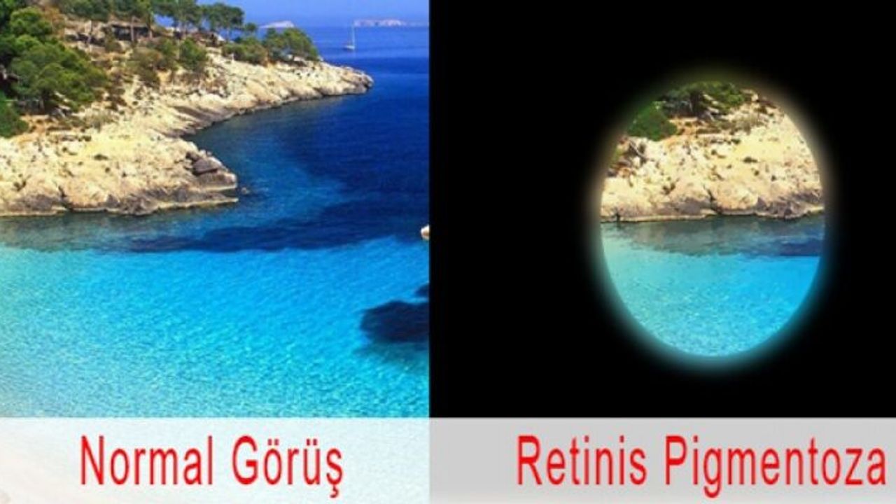 25 binden fazla hastaya umut ışığı!