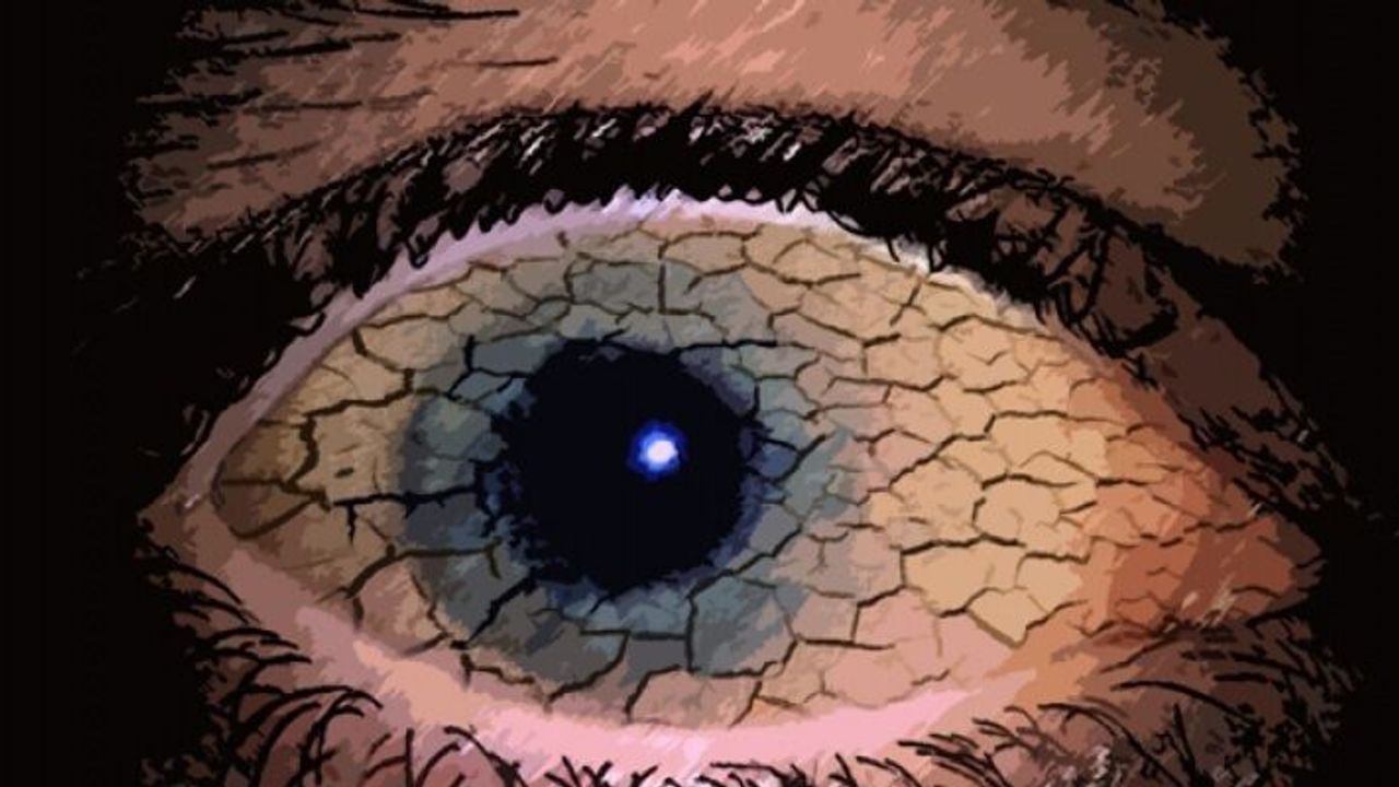 Aman Dikkat ! Göz Kuruluğu Deyip Geçmeyin..