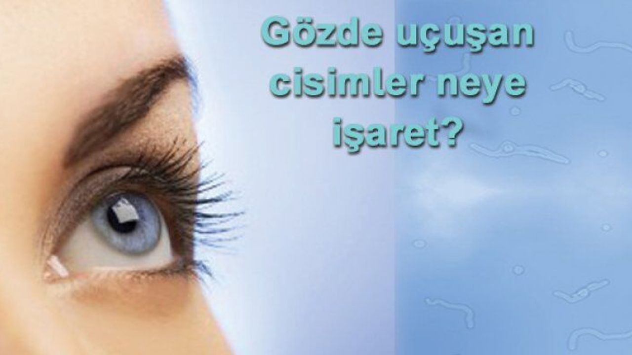 Gözünüzde ilginç cisimler uçuşuyor mu?