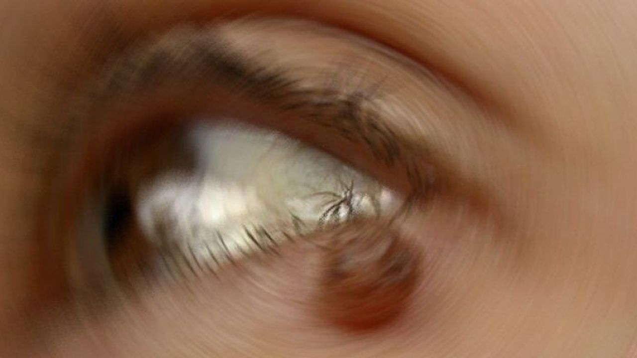 Göz Kapağındaki Benler Tümör Habercisi Olabilir mi?