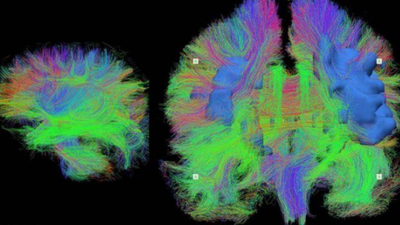 Keşfedilen Yöntemlerle Görme Kaybını Engellemek Mümkün Olabilir mi?