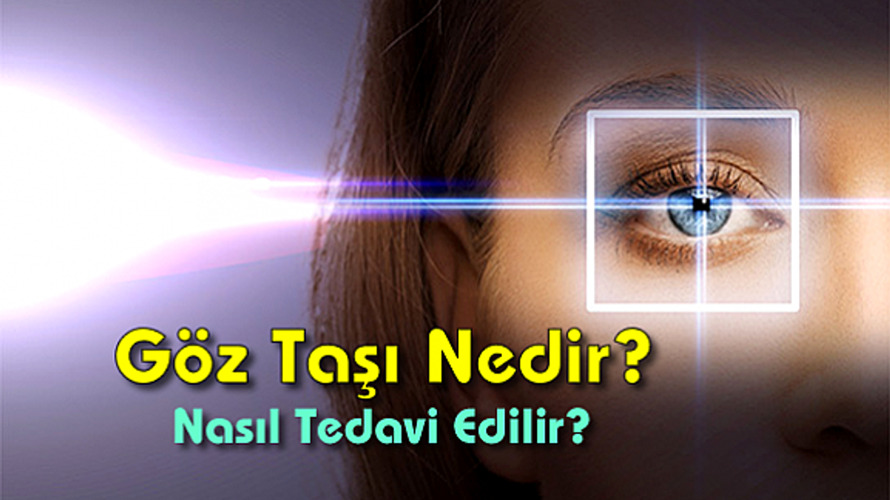 Göz Taşı Nedir? Nasıl Tedavi Edilir?