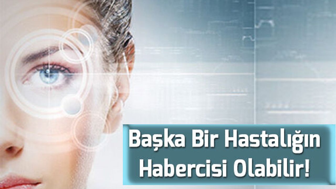 Bu Hastalıklar İlk Olarak Gözde Belirti Veriyor