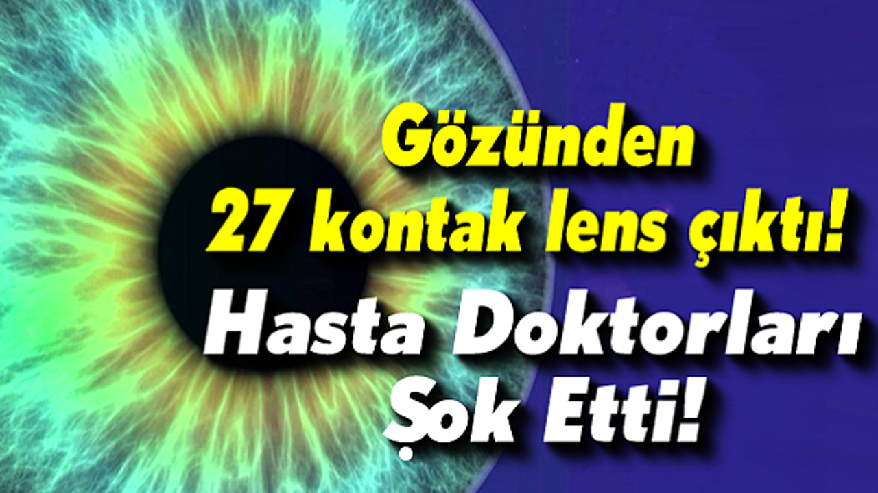 Katarakt ameliyatına gelen hastanın gözünden 27 lens çıktı!