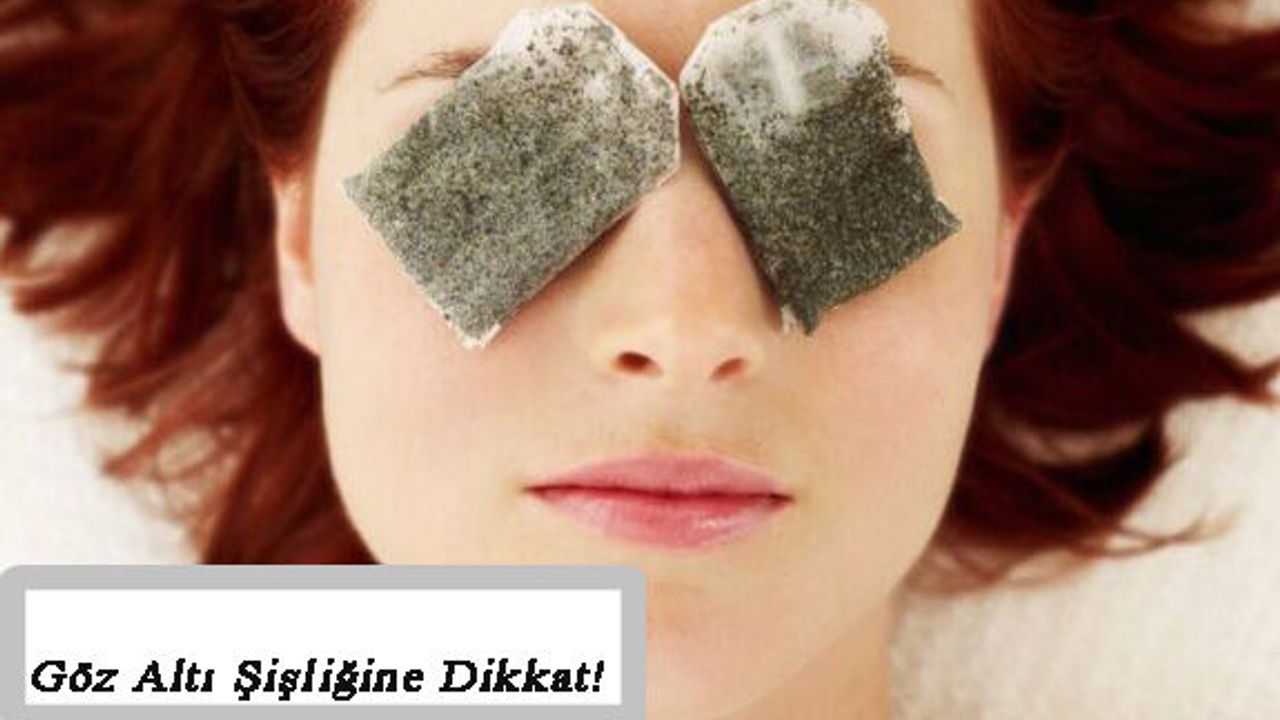 Göz Altı Şişliği ve Göze Etkileri