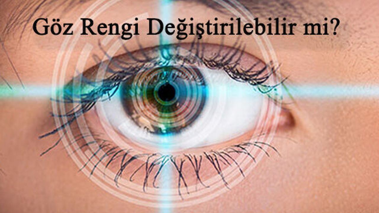 Göz Rengi Değiştirme Operasyonları Hakkında Bilinmesi Gerekenler