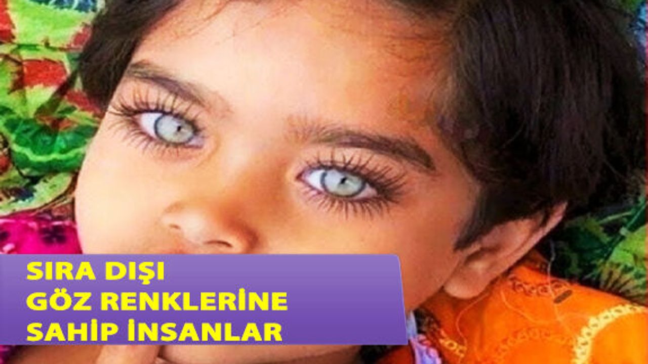 Sıra Dışı Göz Renkleriyle İnsanları Büyüleyen 6 Kişi