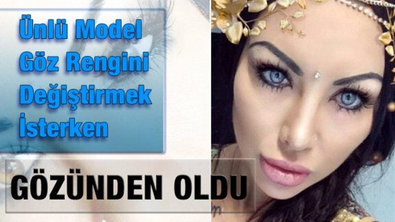 Göz Rengini Değiştirme Ameliyatı Gözünden Etti!