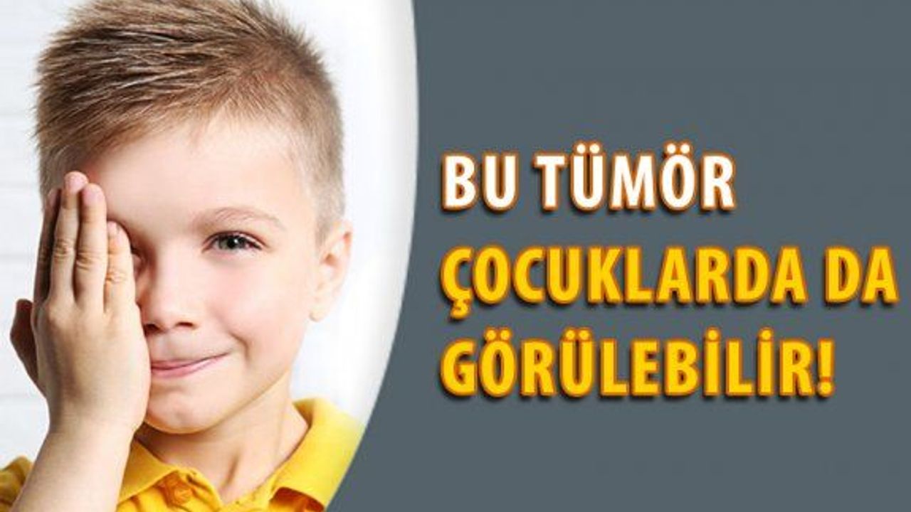 "Göz Tümörleri Çocukluk Çağında da Görülebilir. "