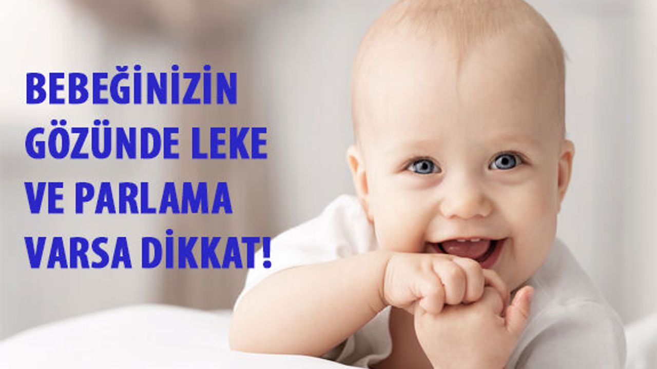 Bebeğinizin Gözünde Leke ve Parlama Varsa Dikkat!