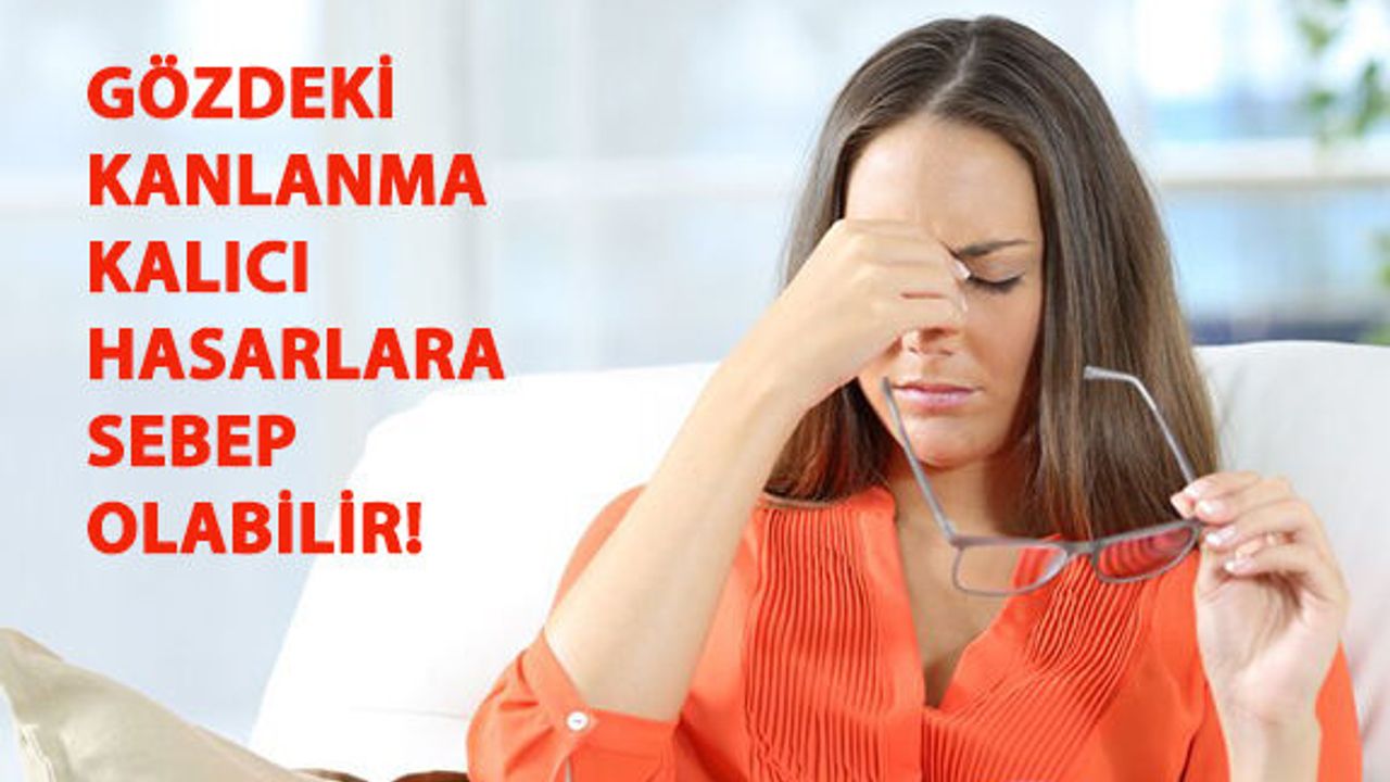 Gözdeki Kanlanma Kalıcı Hasarlara Sebep Olabilir!
