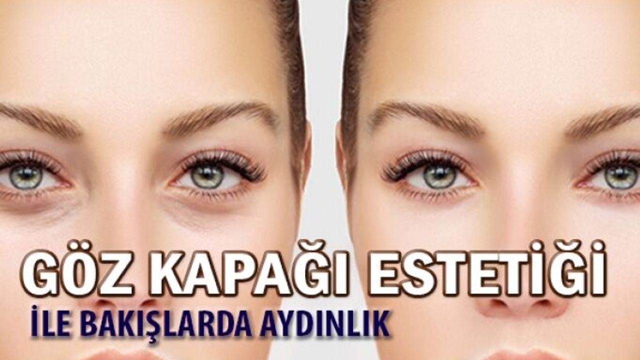 Göz Kapağı Estetiği ile Bakışlarınız Aydınlanıyor