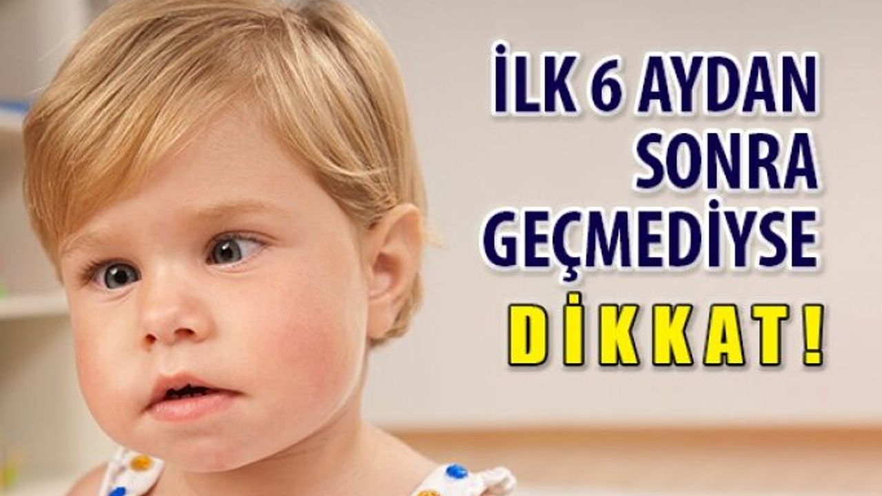 Göz Kayması İlk 6 Ayda Geçmediyse DİKKAT!