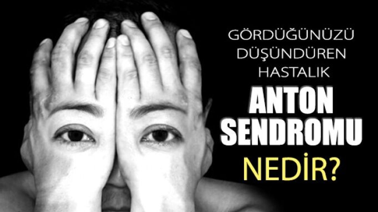Beynin Göze Yaptığı İllüzyon; Anton Sendromu