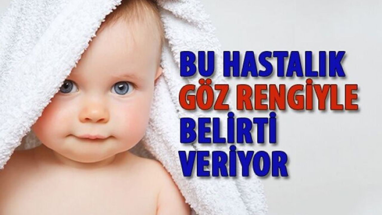 Bu Hastalık Göz Rengiyle Belirti veriyor