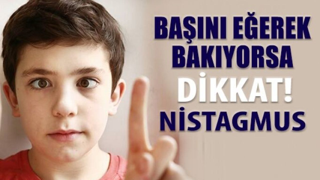 Göz Titremesi (Nistagmus) Nedir?