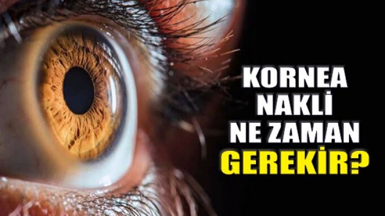 Kornea Hastalığına Bağlı Görme Kaybında Tedavi Nasıl Yapılır?