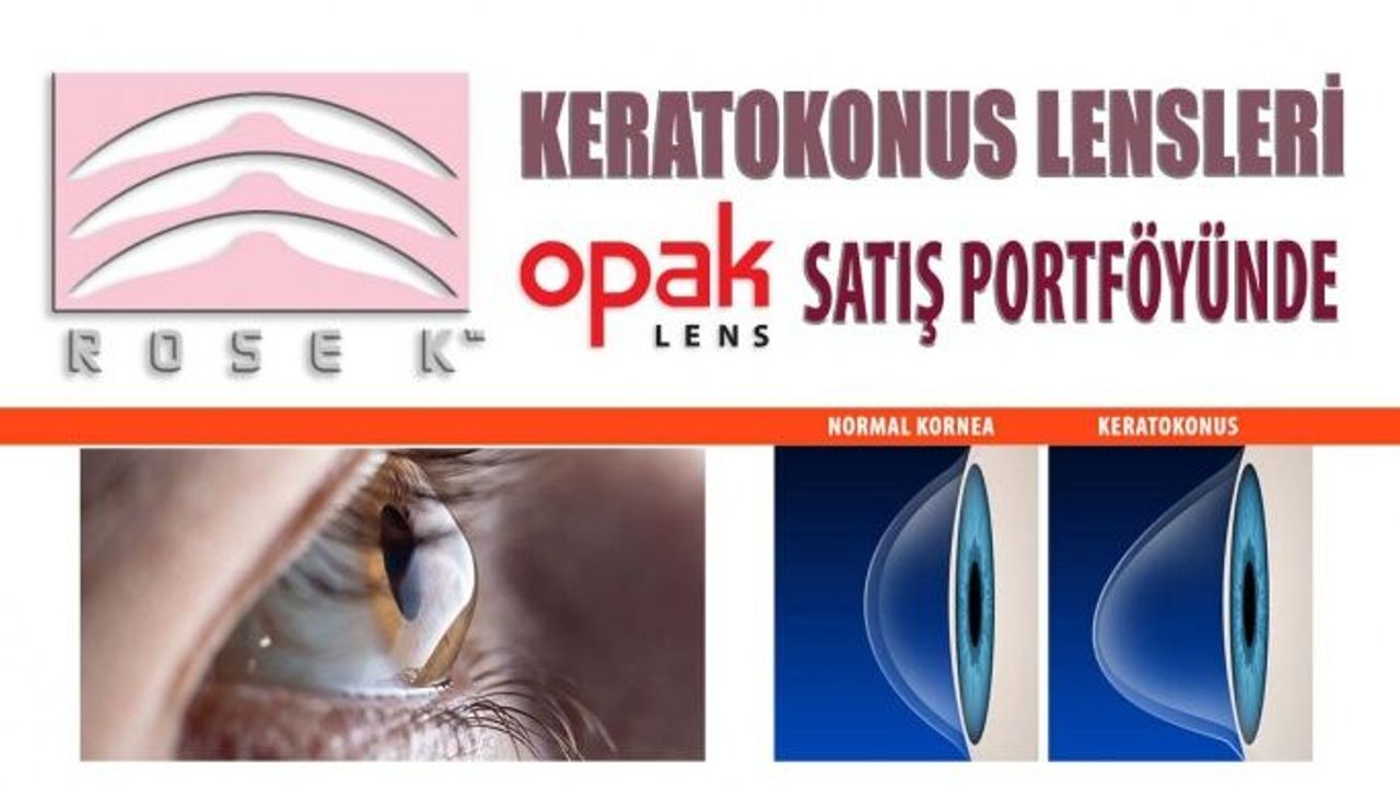 ROSE K Keratokonus Lensleri Opak Lens Satış Portföyünde