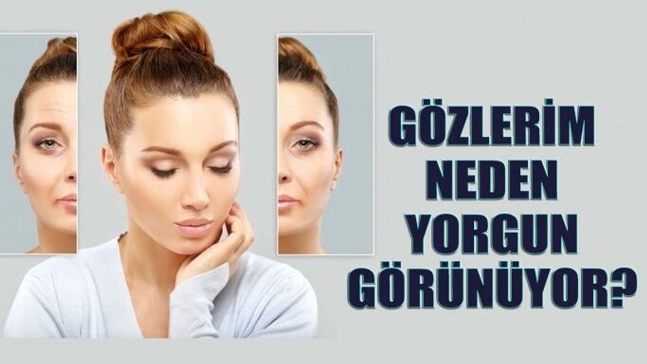 Gözleriniz Neden Yorgun Görünüyor? Yorgun Göz Sorunu