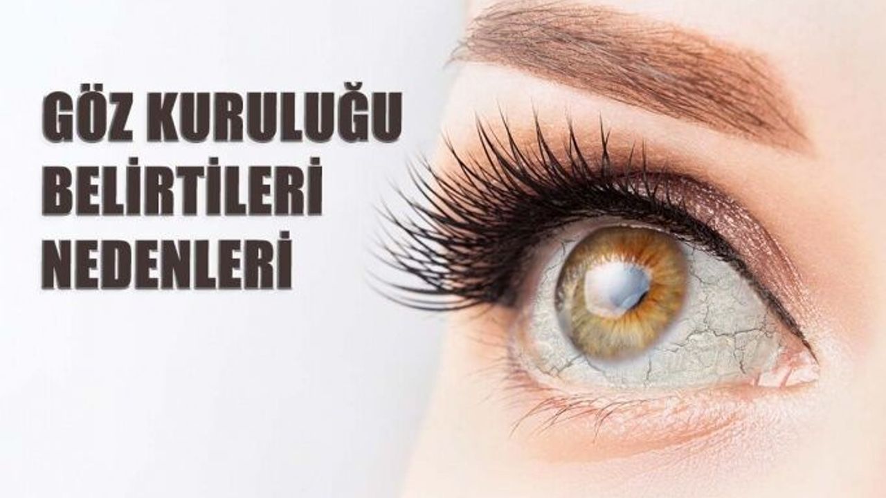 Göz Kuruluğu Neden Olur Belirtileri Nelerdir