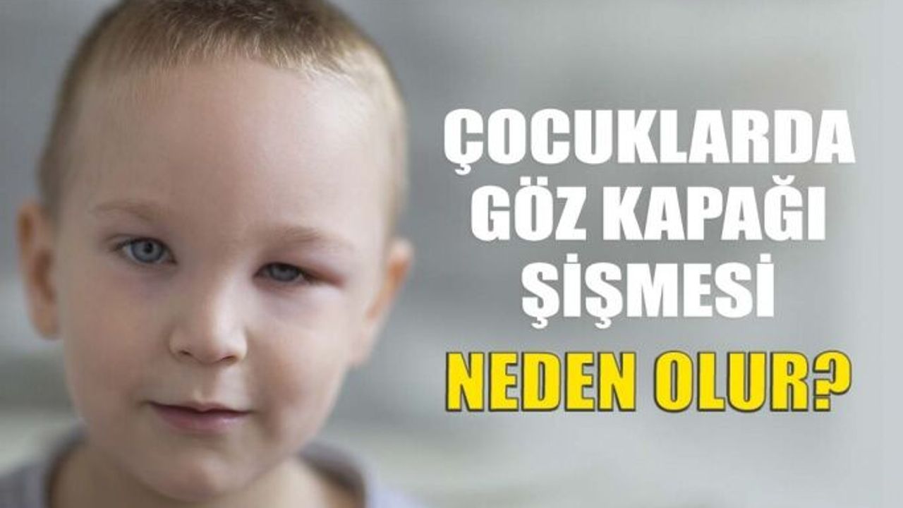 Çocuklarda Göz Kapağı Şişmesi Neden Olur?