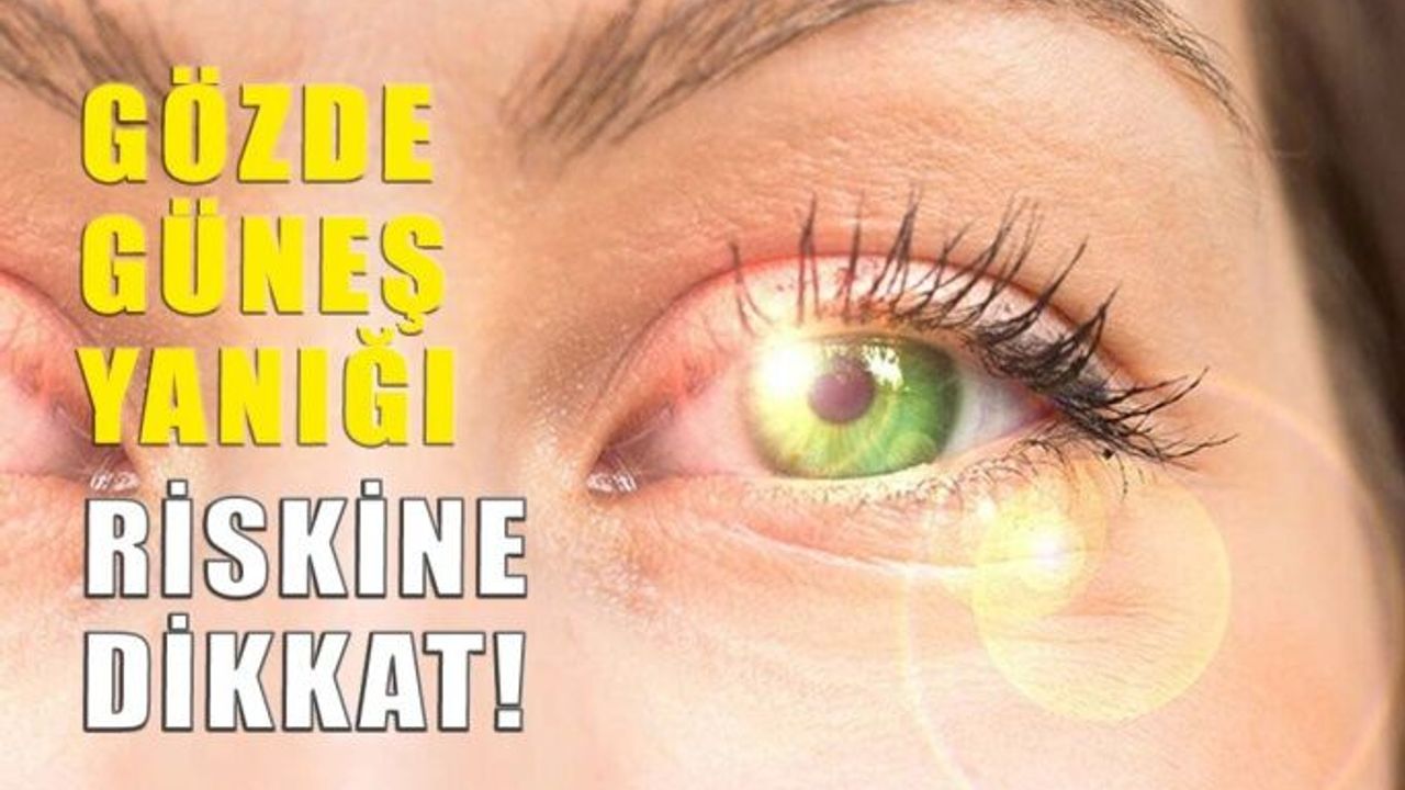 Yazın Çocuklarda Gözde Güneş Yanığı Riskine Dikkat!