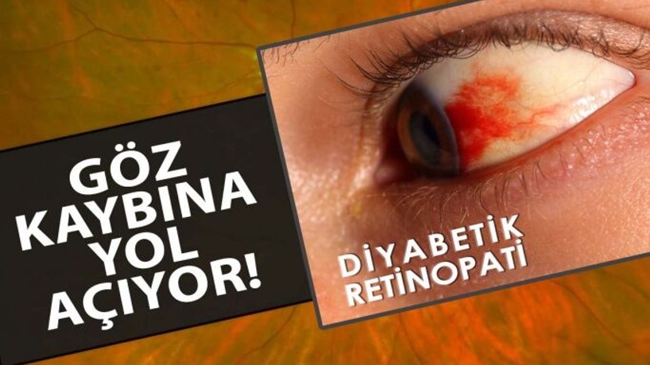 Diyabetik Retinopati Göz Kaybına Yol Açıyor!
