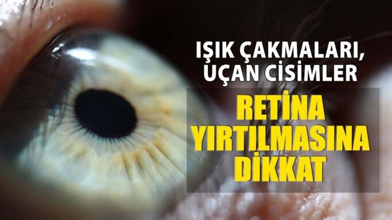 Gözlerde Işık Çakmaları, Uçan Cisimler Retina Yırtılması Habercisi