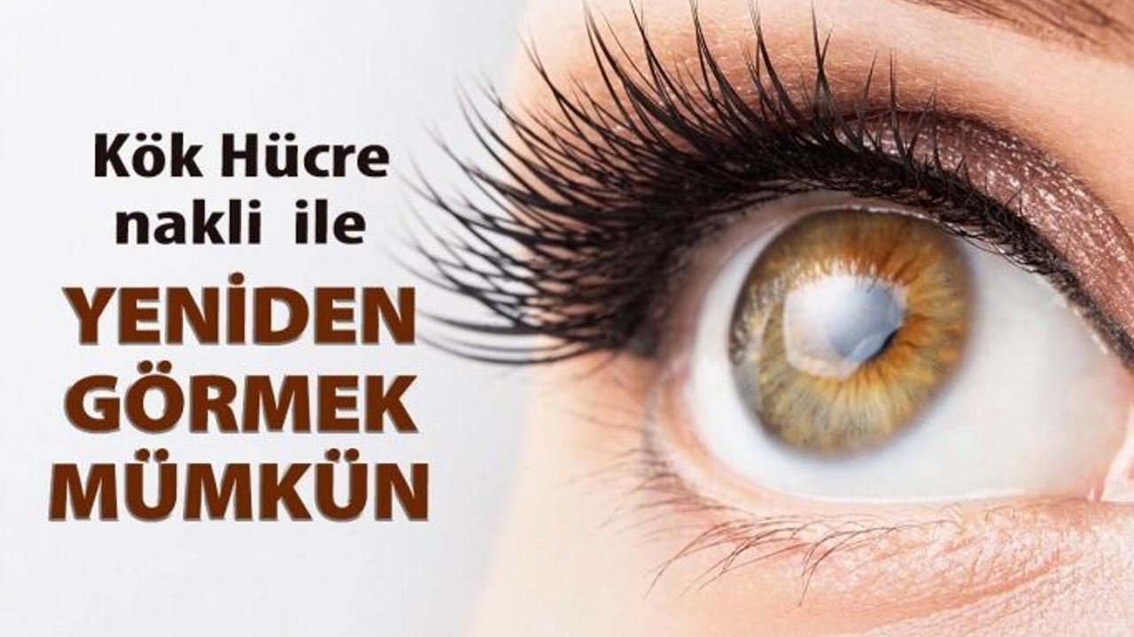 Kök Hücre Nakli İle Kornea Nakli Olmadan Tekrar Görmek Mümkün