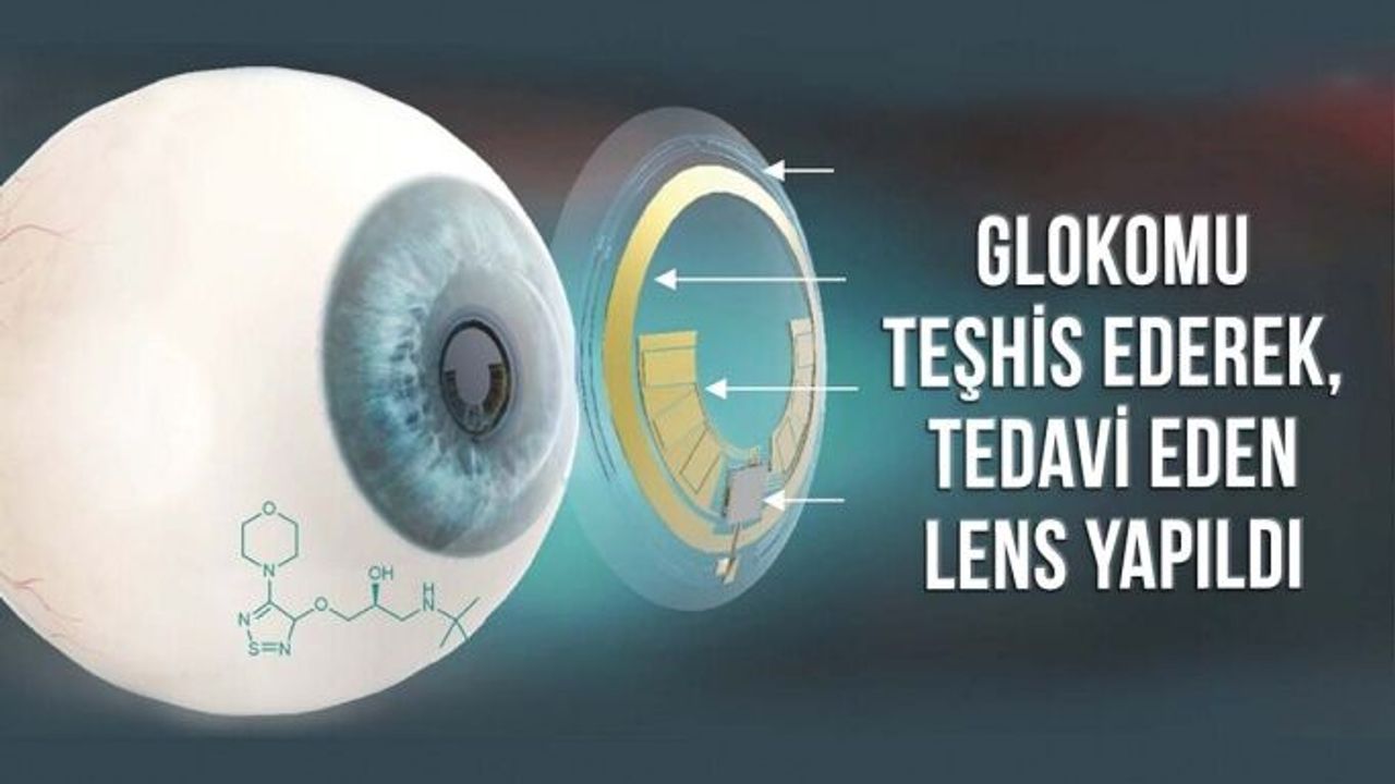 Glokomu Teşhis Ederek, İlaçla Tedavi Eden Akıllı Kontak Lens Yapıldı