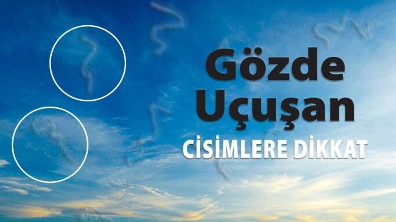 Gözünüzde Uçuşan Cisimler ve Işık Çakmaları Varsa Dikkat!