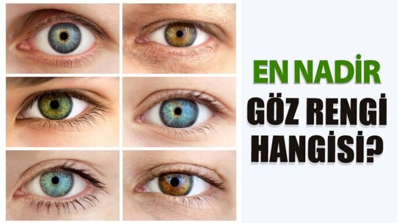 En Nadir Göz Rengi Hangisi Biliyor Musunuz?