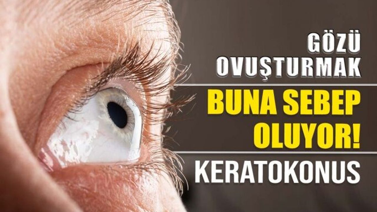 Gözleri Ovuşturmak Keratokonusa Sebep Oluyor
