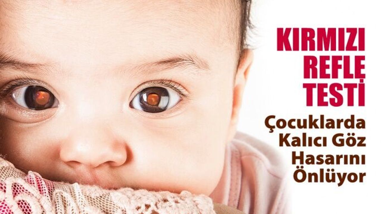 Kırmızı Refle Testi Çocuklarda Kalıcı Göz Hasarını Önlüyor
