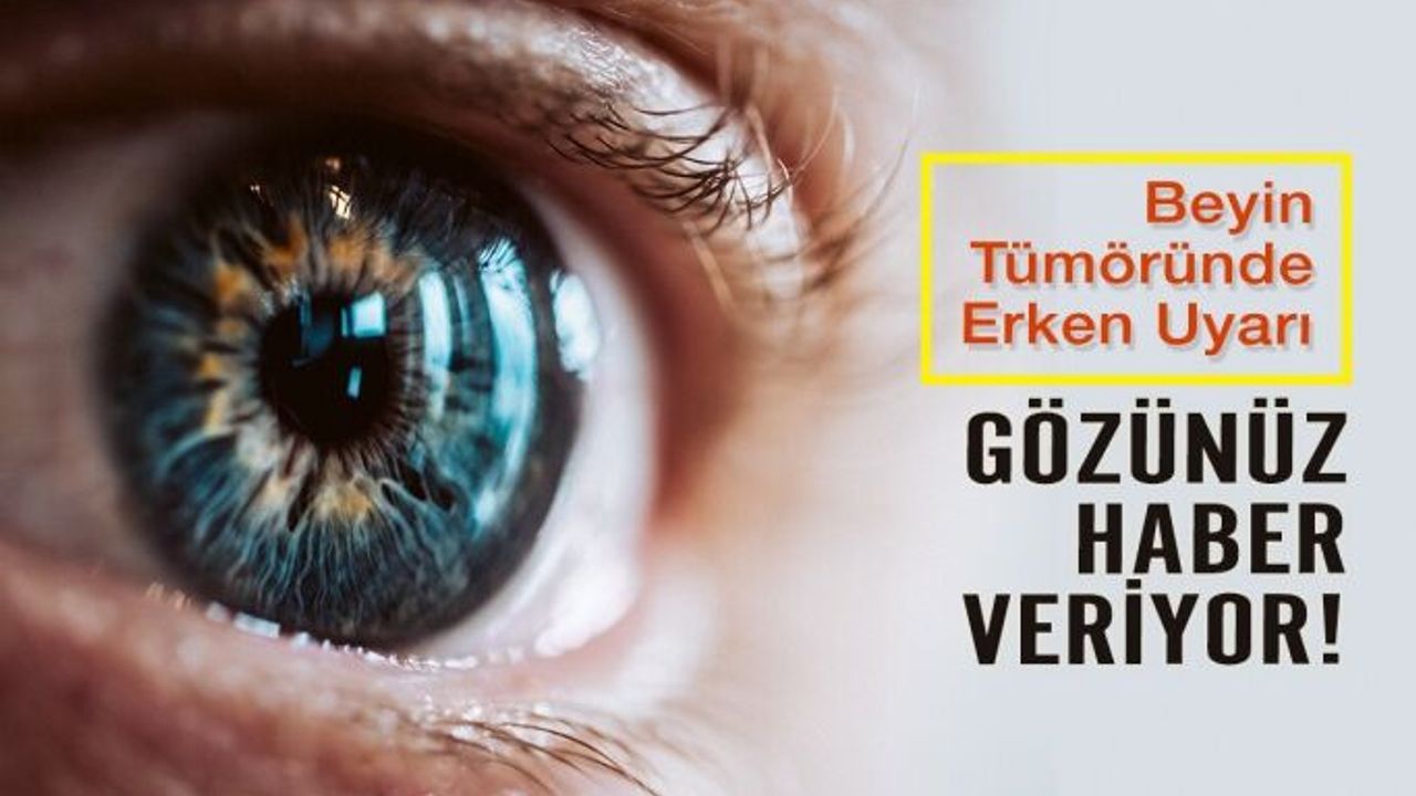 Gözleriniz Beyin Tümörü Habercisi Olabilir!