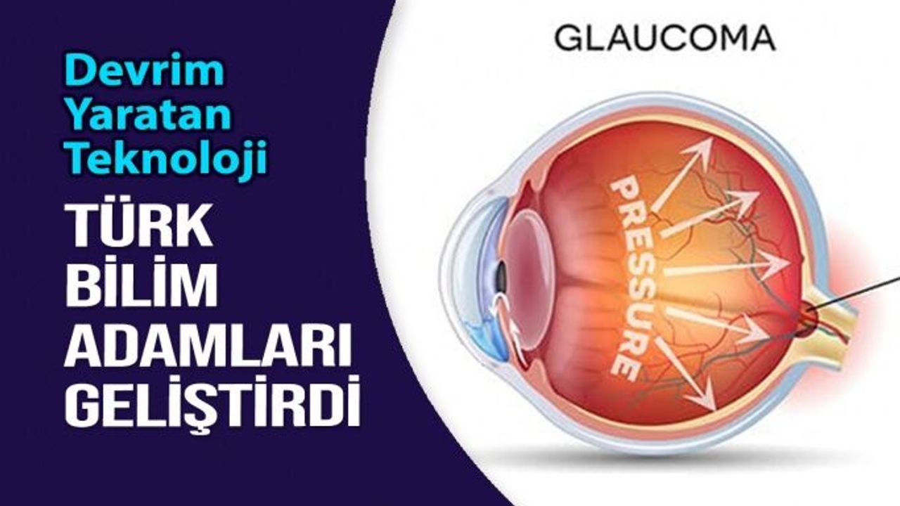 Türk Bilim Adamlarının Geliştirdiği Kontak Lens Glokomu Teşhis Ediyor