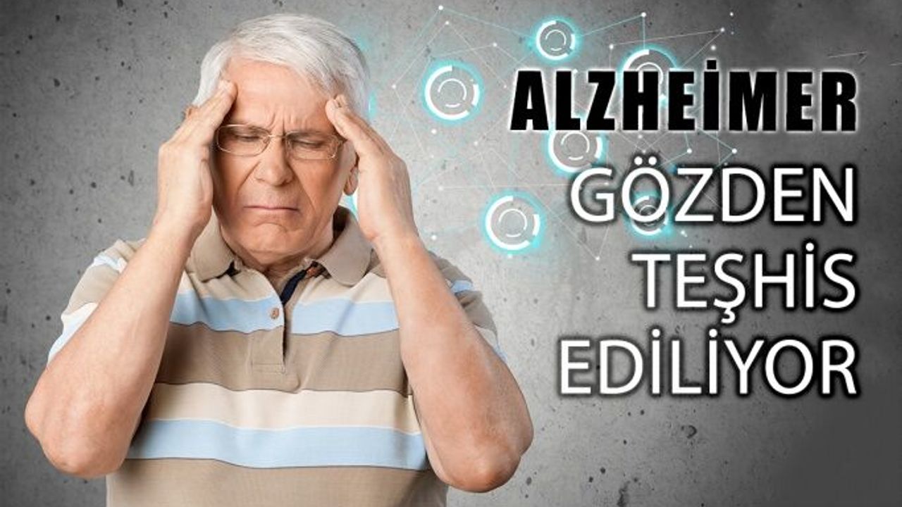 Alzheimer Gözden Erken Teşhis Edilebiliyor