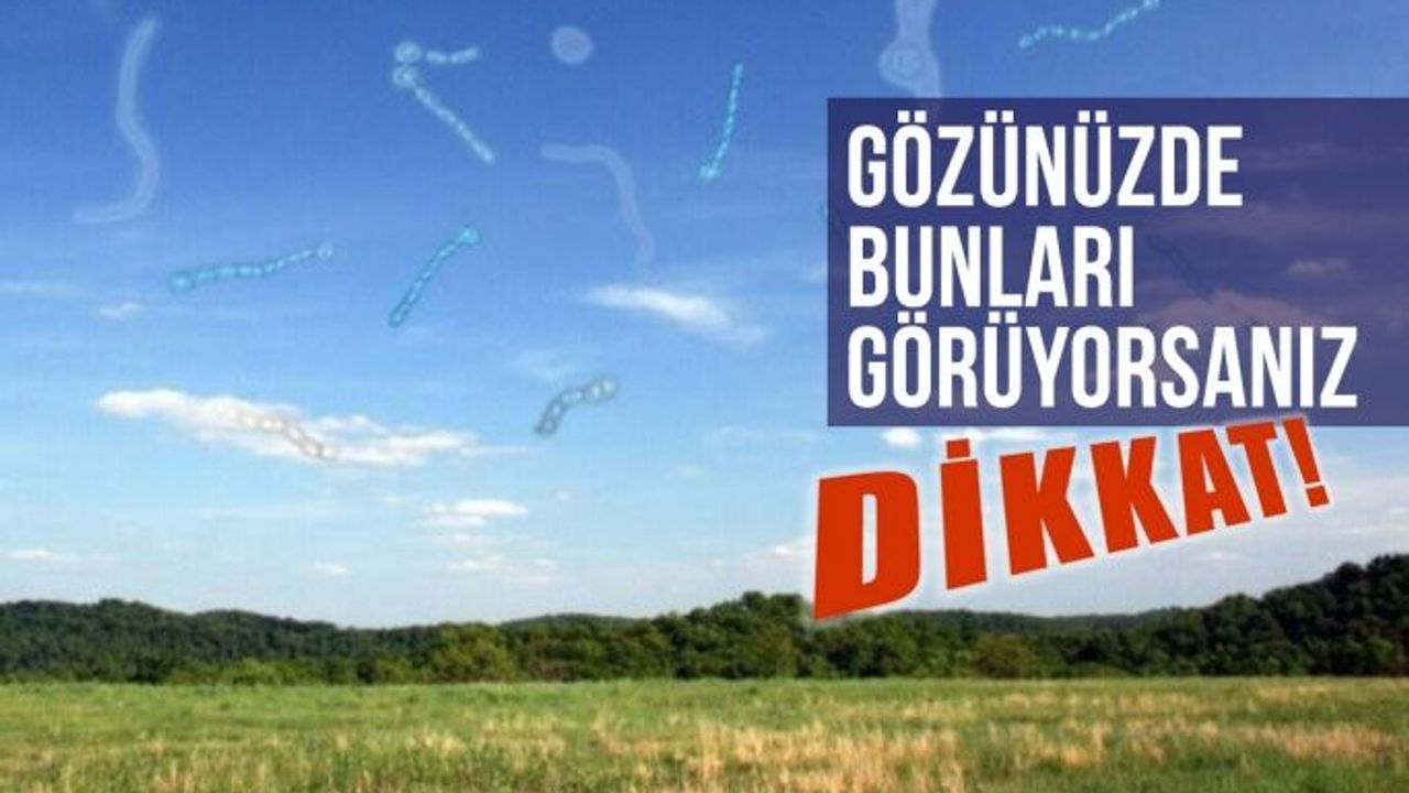 Gözünüzde Uçuşan Cisimler Görüyorsanız Dikkat!