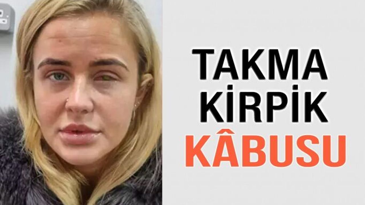 Takma Kirpik Kör Ediyordu!