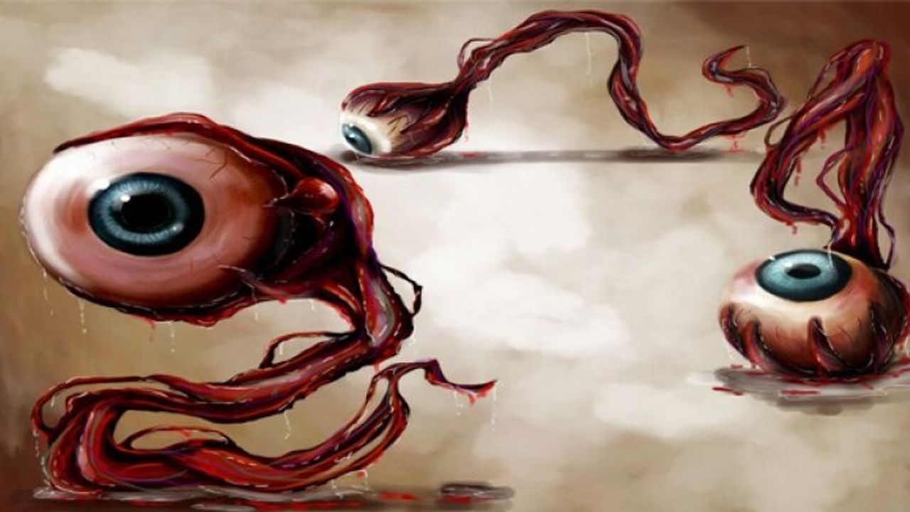 Göz Migreni Geçici Görme Kayıplarına Sebep Oluyor!