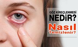 Göz Kireçlenmesi Nedir? Nasıl Tedavi Edilir?