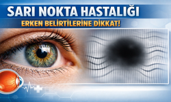 Sarı Nokta Hastalığının Erken Belirtilerine Dikkat!