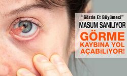 Göz Etine Yol Açan 4 Önemli Etken!