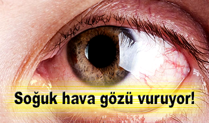 Soğuk alerjisiyle geldi!