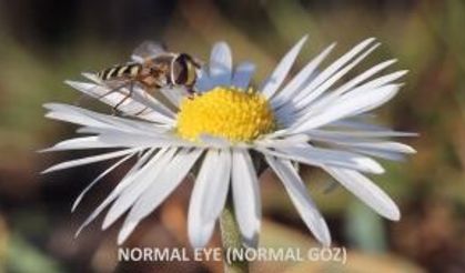 GÖZ BOZUKLUKLARI - Astigmatizm - Miyop - Hipermetrop