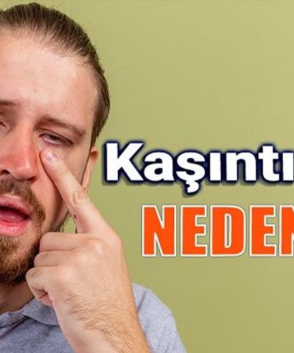 Göz Kaşıntısının Nedenleri Nelerdir?