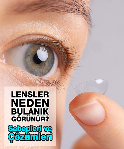 Kontak Lenslerim Neden Bulanık Gösteriyor?